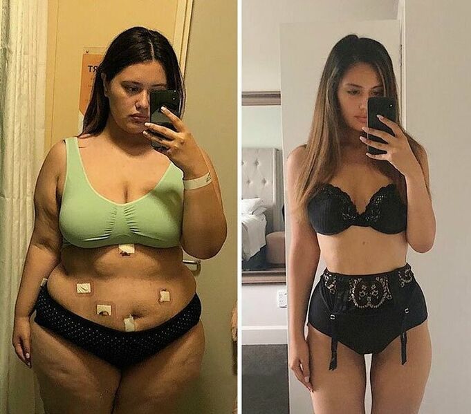 Κορίτσι πριν και μετά την απώλεια βάρους με κάψουλες KETO Complete
